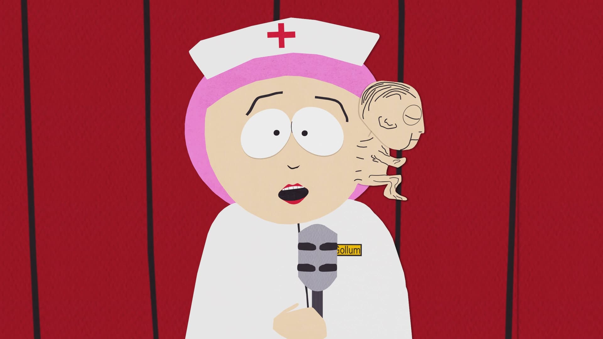 Le Foetus siamo-maxillaire Le Foetus siamo-maxillaire